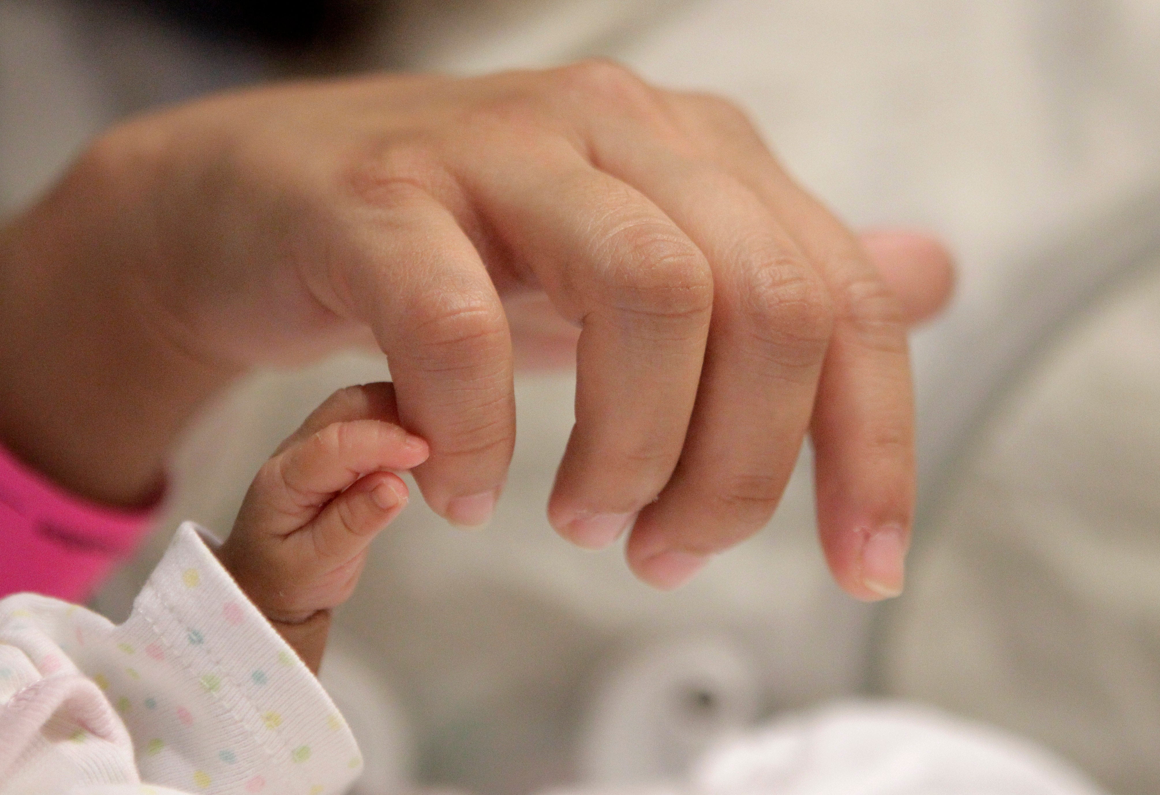 One Of World s Tiniest Babies In Pictures Photo 8 Pictures CBS News one-of-world-s-tiniest-babies-in-pictures-photo-8-pictures-cbs-news