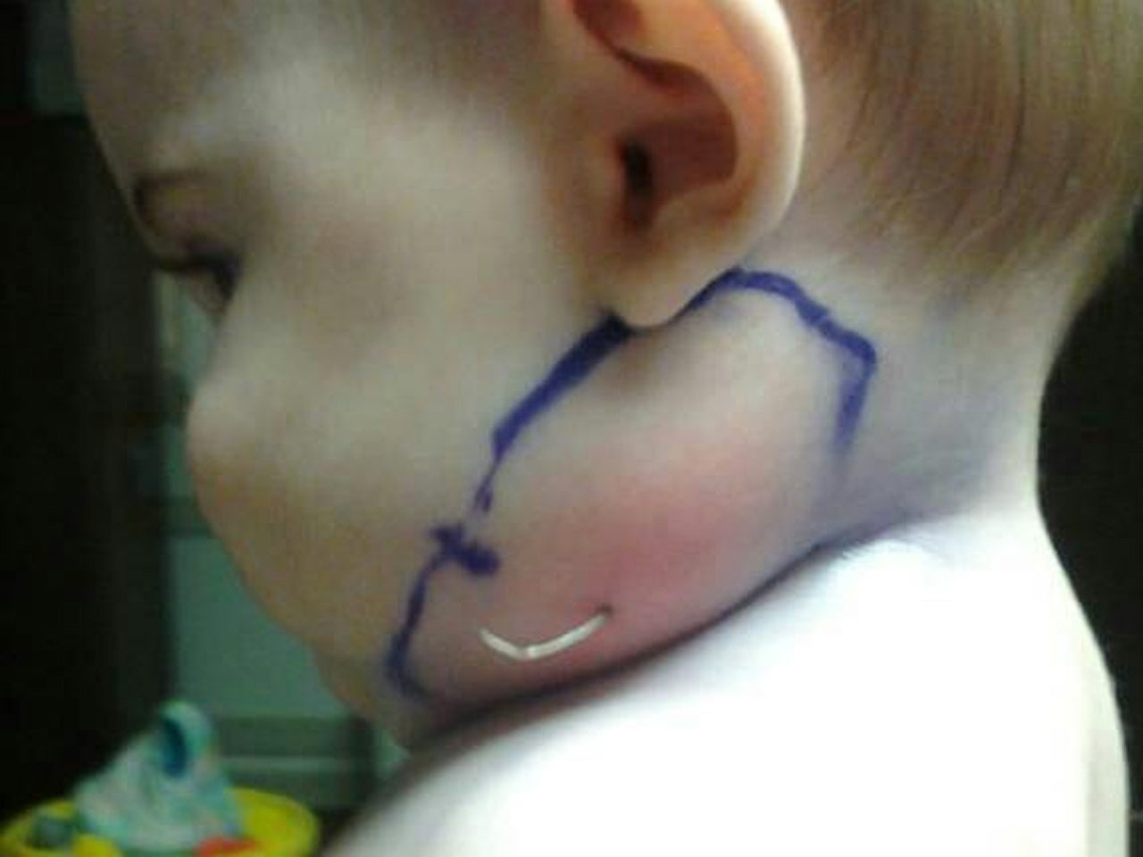 Feather pulled from baby's neck - Photo 3 - Pictures - CBS ...