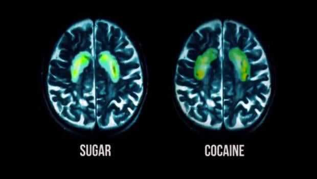 Sugar Brain Sugar Brain