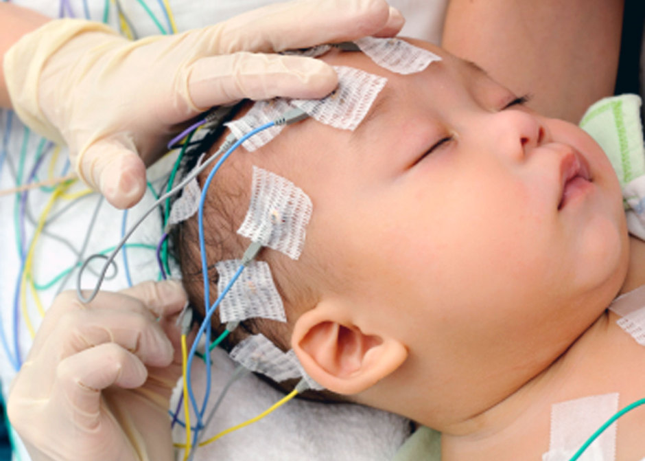 what is an eeg test used to diagnose
