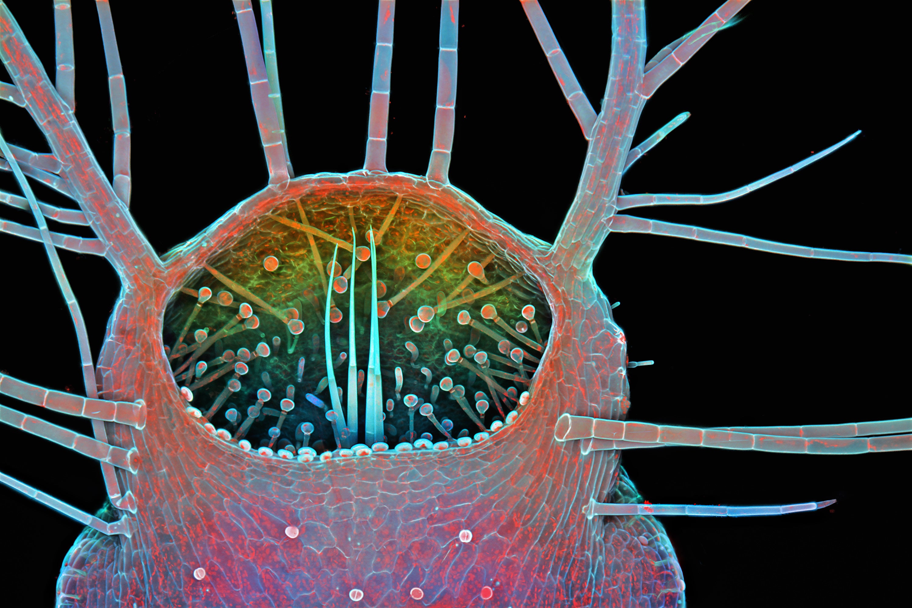 Top Prize Winner - Microscopic beauty: Winning images from the Nikon
