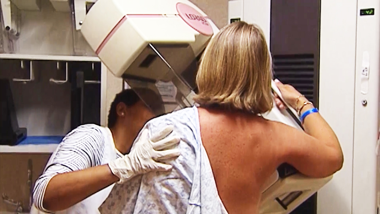 American Cancer Society changes mammogram guidelines CBS