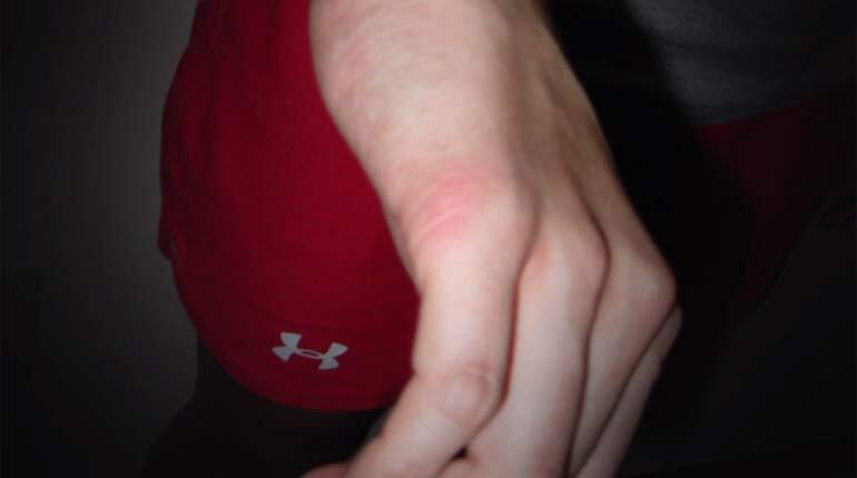 Police photographed marks on Taylor Gould's hand