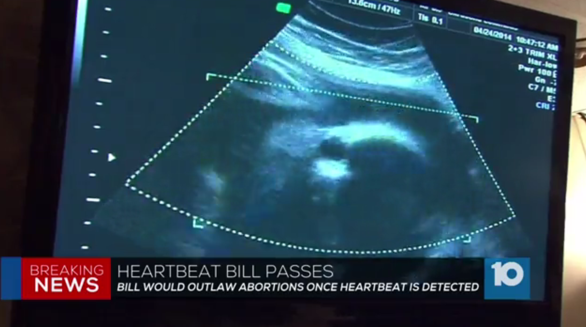 heartbeat bill heartbeat bill