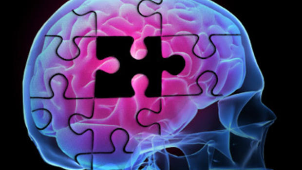 case studies of transient epileptic amnesia