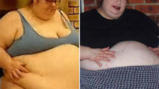 Donna Simpson World S Fattest Mom Cbs News