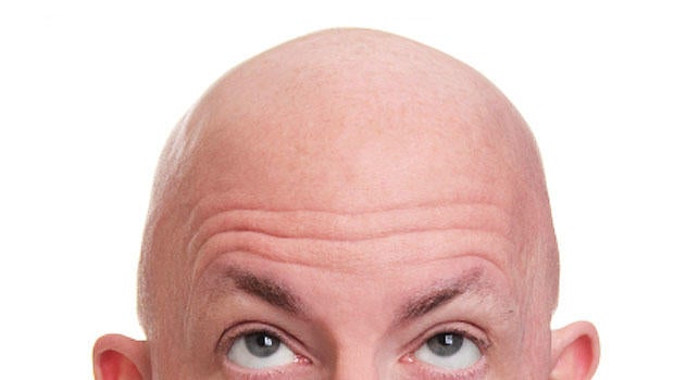 bald man