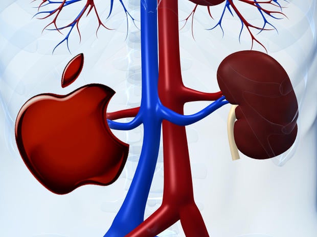 apple, ipad, kidney, stock, 4x3