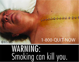 Smoking can kill you