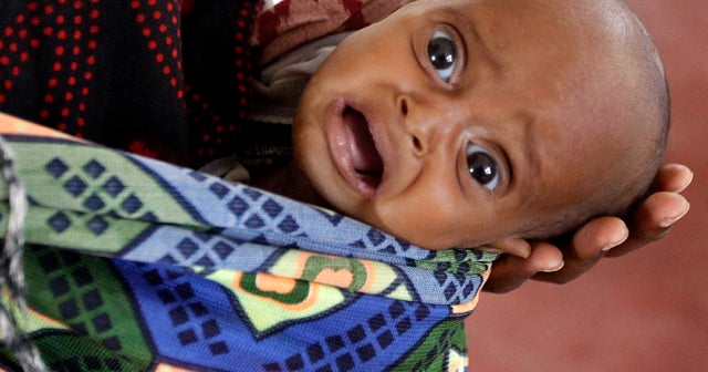 U.S.: 29,000 Somali kids have died in last 90 days - CBS News