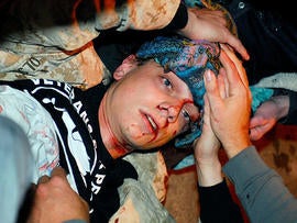 In this photo taken Oct. 25, 2011, 24-year-old Iraq War veteran Scott Olsen lays on the ground bleeding from a head wound after being struck by a by a projectile during an Occupy Wall Street protest in Oakland, Calif.