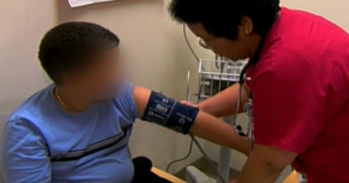 Childhood obesity rates fall slightly, say CDC researchers Childhood obesity rates fall slightly, say CDC researchers