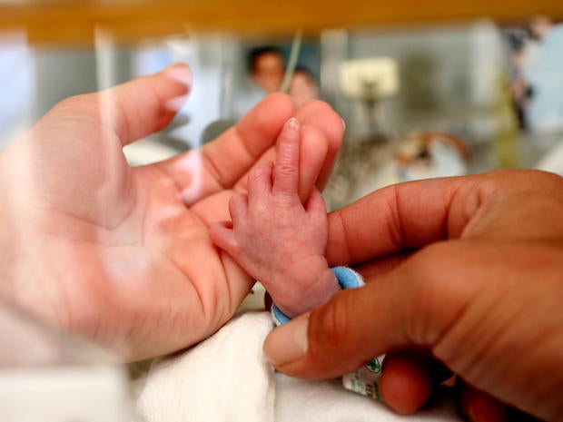preterm birth, premature birth