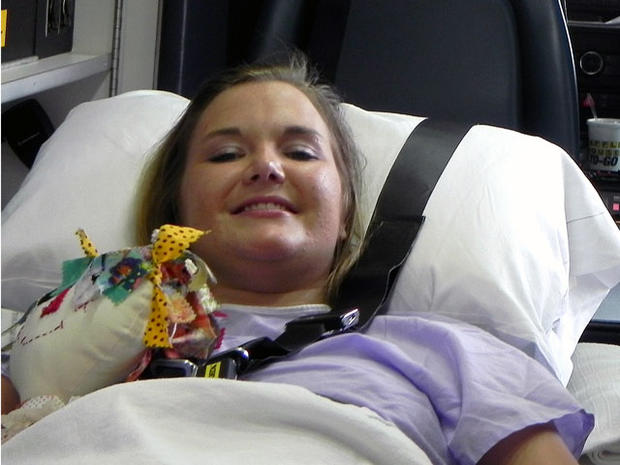 aimee copeland, necrotizing fasciitis, flesh-eating bacteria