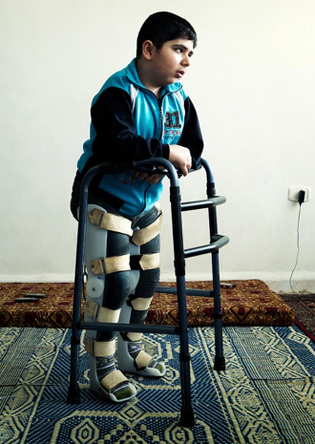 Bashar, 12, is virtually trapped in a 5th floor apartment