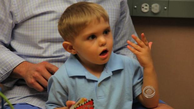 Grayson Clamp hears for the first time following surgery.