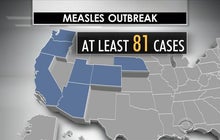 Should states allow parents to waive vaccinations?