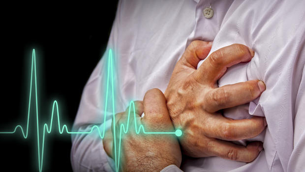 Sudden cardiac arrest may have warning signs after all