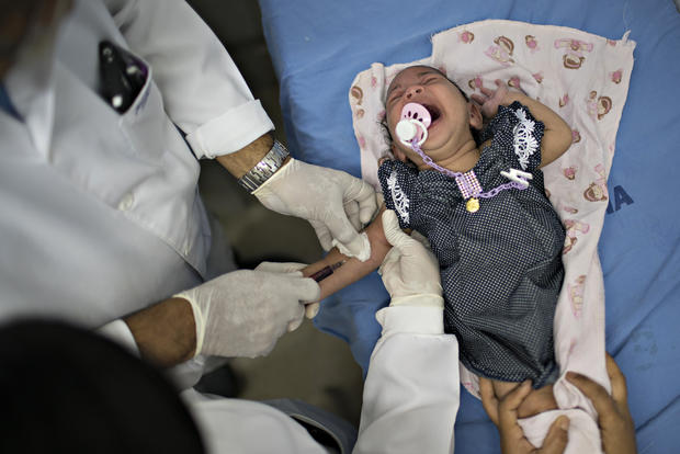 Zika Virus Zika Virus Takes Heartbreaking Toll Pictures Cbs News 0047