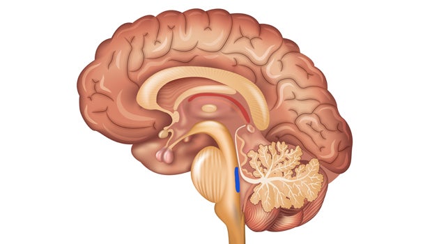 Have researchers found "ground zero" for Alzheimer's?