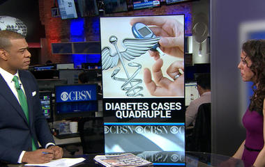 Diabetes cases have quadrupled since 1980 