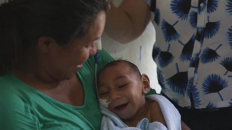 Zika virus confirmed in Palau
