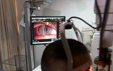 Scientists working on restoring human sight with pig eyes
