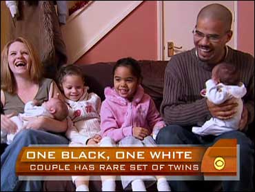 Baby black couple to give white birth White Baby