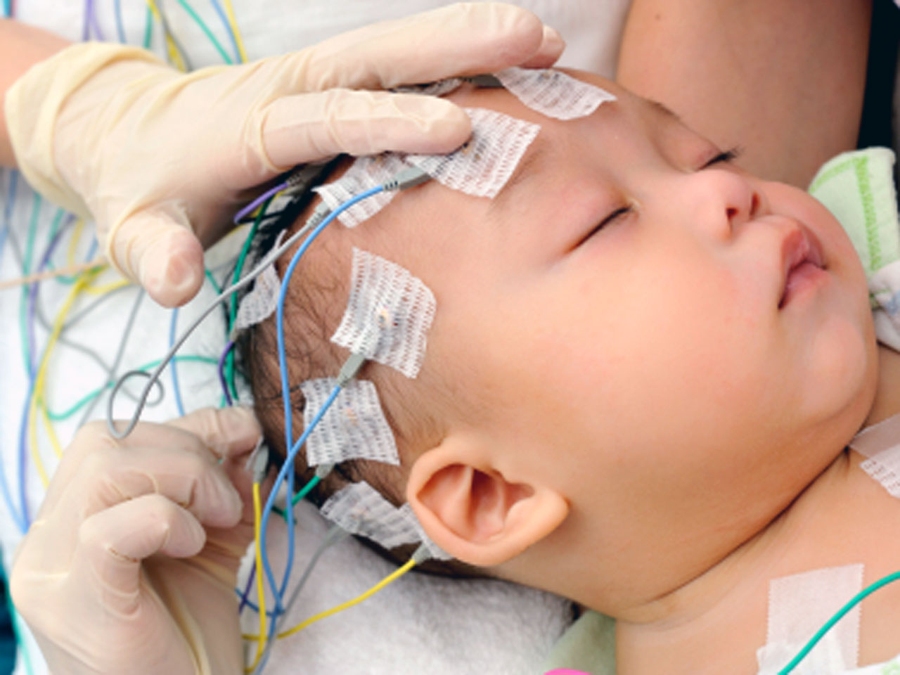 what is eeg test