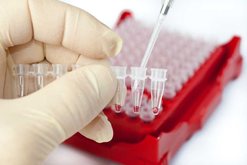New DNA test may provide noninvasive alternative for