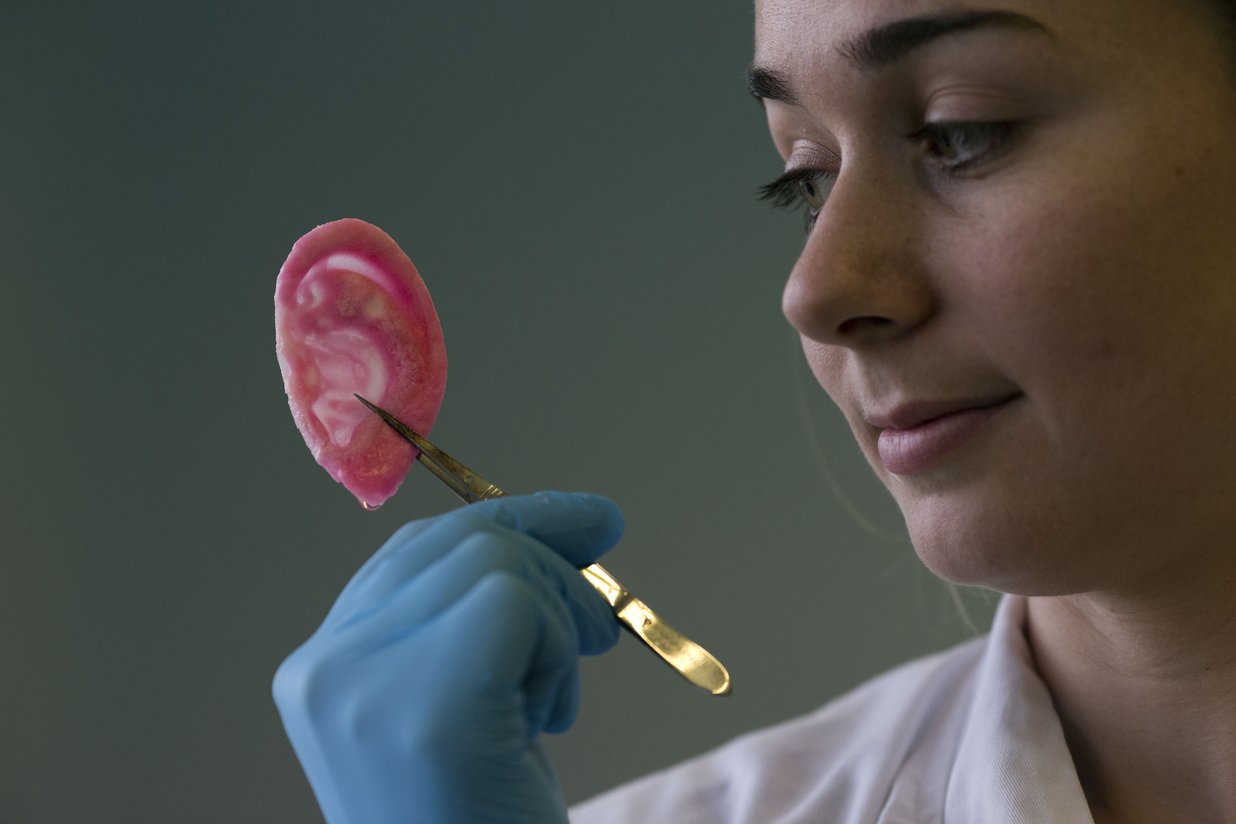 Royal Free Hospital - London scientists grow noses and ears - Pictures - CBS News5184 x 3456