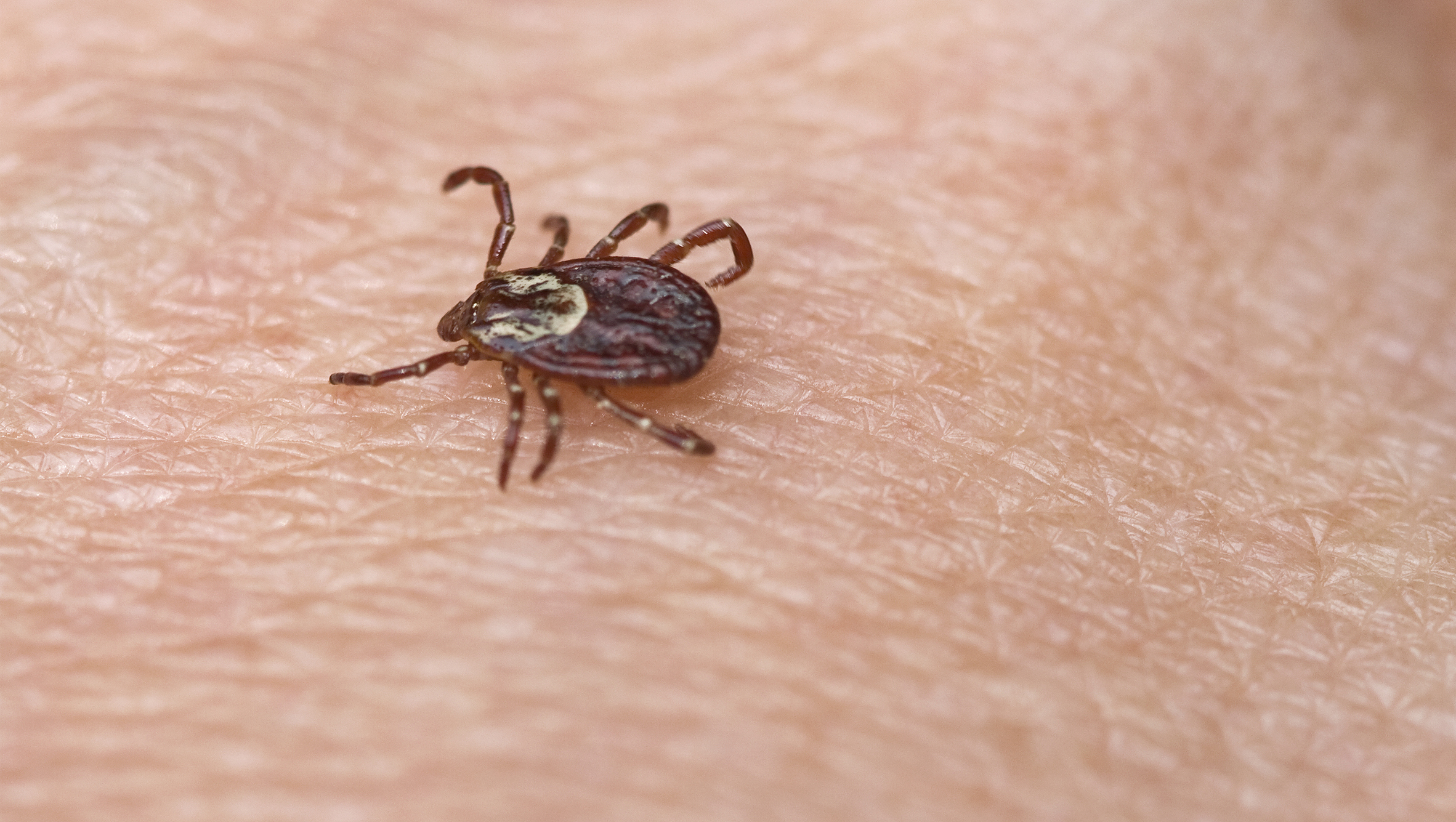 Powassan virus, spread by ticks, could be worse than Lyme disease - CBS News2364 x 1335
