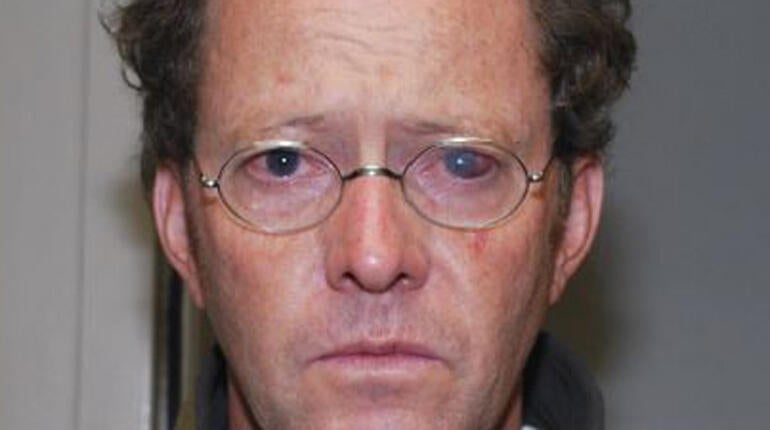 Police photographed Johnny Wall's eye injury.
