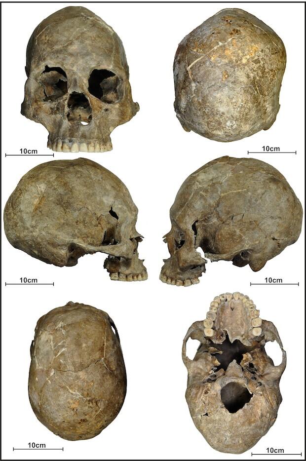 sep-26-cranio.jpg