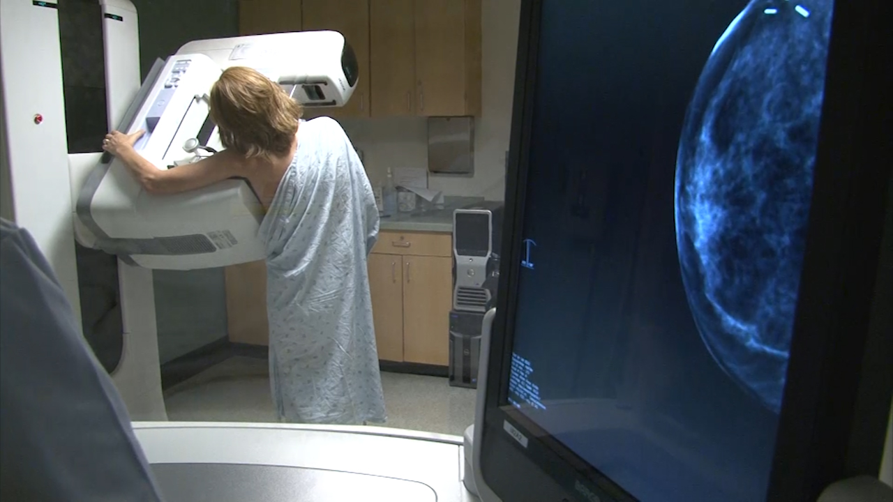 Task Force Issues Breast Cancer Screening Recommendations Cbs News