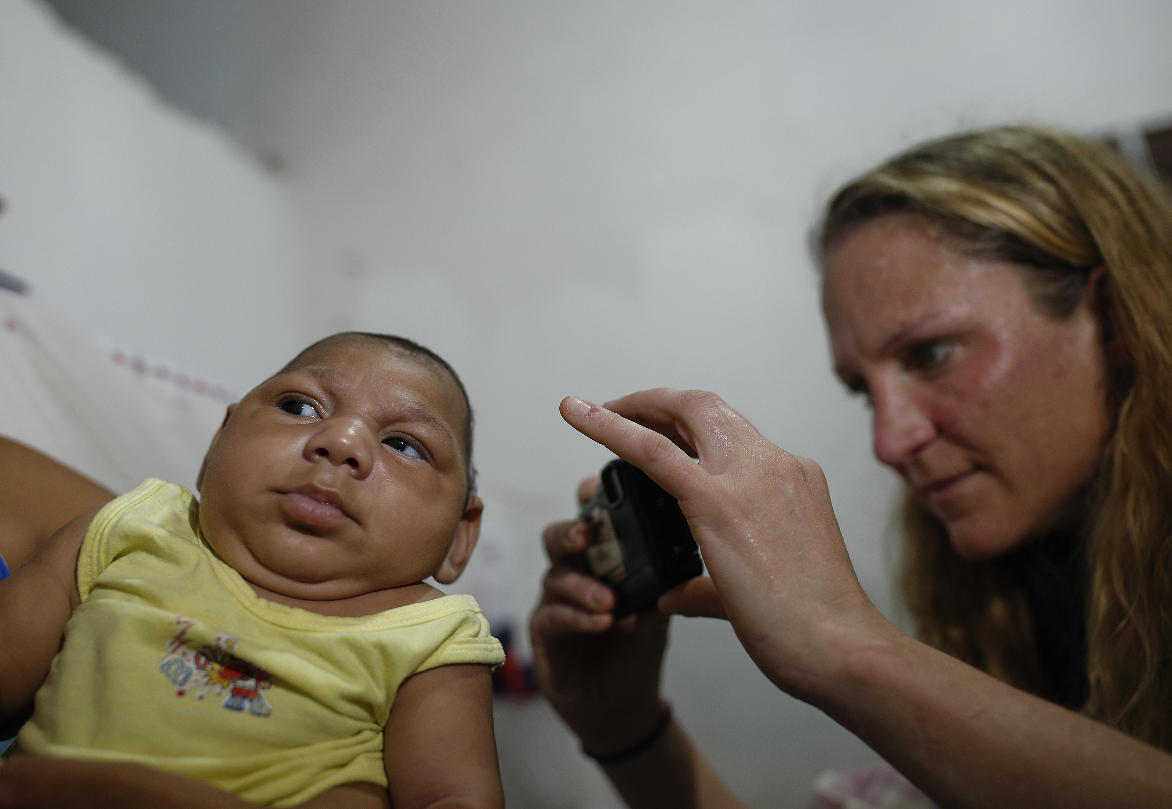 Researchers Slowly Homing In On Risk Of Zika Birth Defect Cbs News 1941