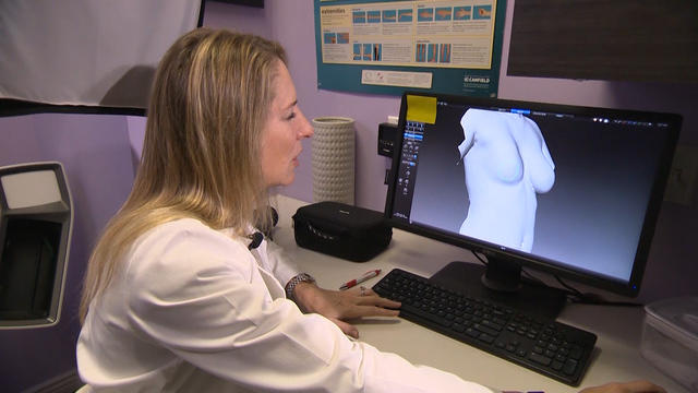 Why Some Women Are Undergoing Breast Explants Cbs News