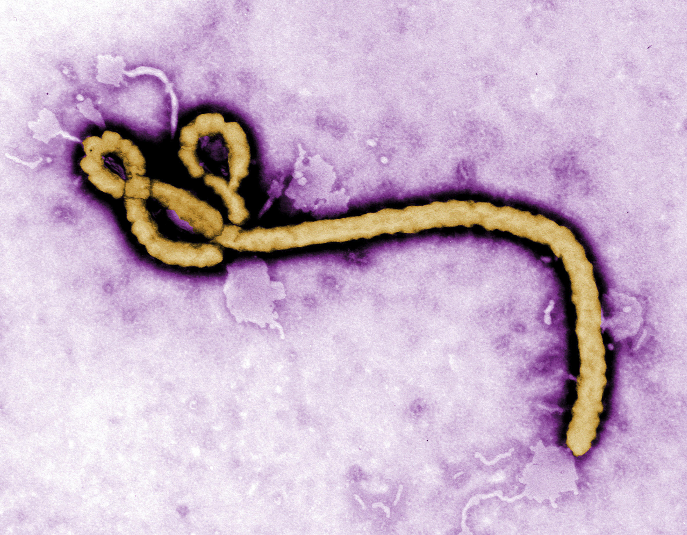 Woman Likely Spread Ebola One Year After Infection Doctors - 