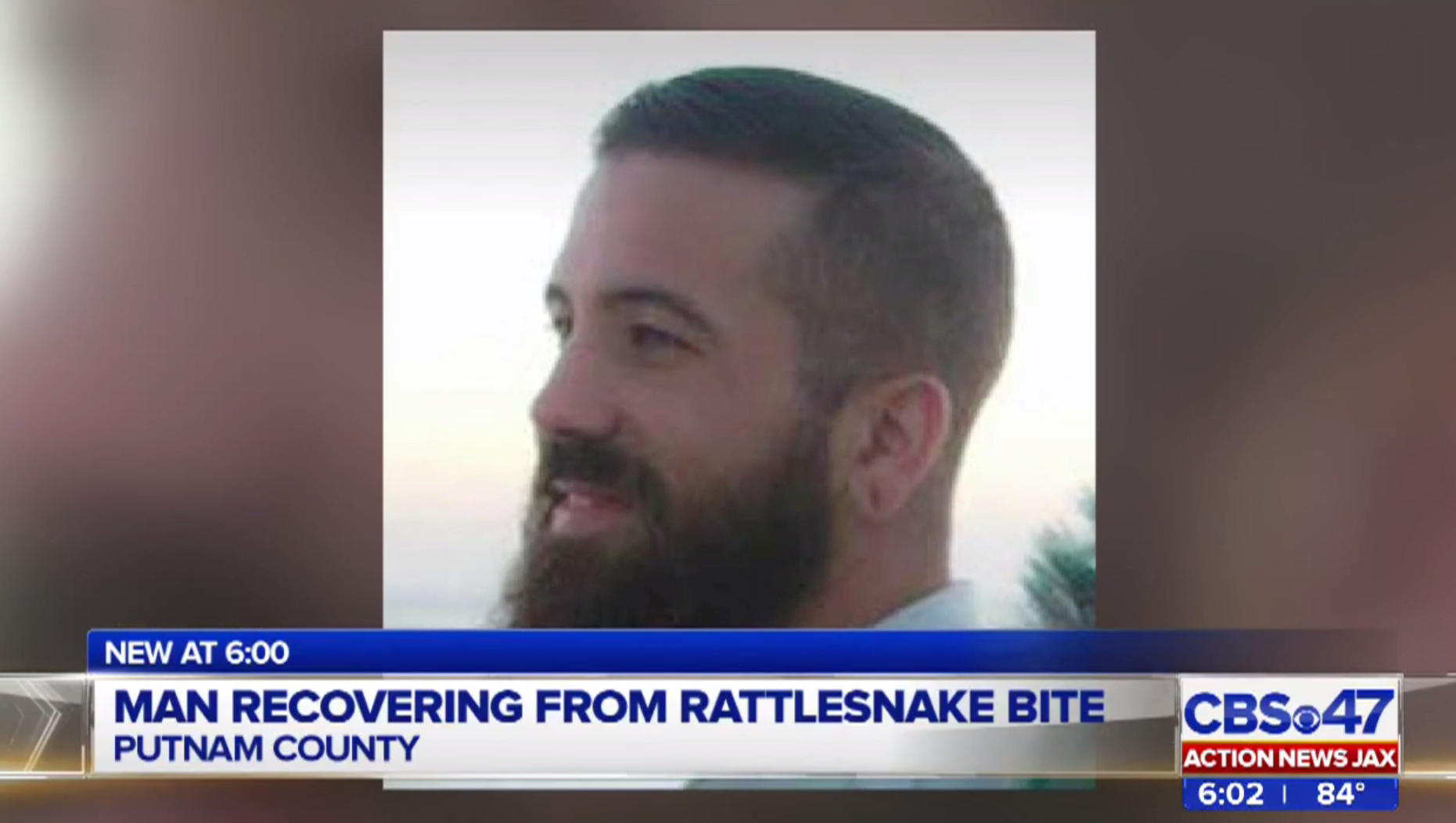 Florida man bitten on the tongue by rattlesnake - CBS News