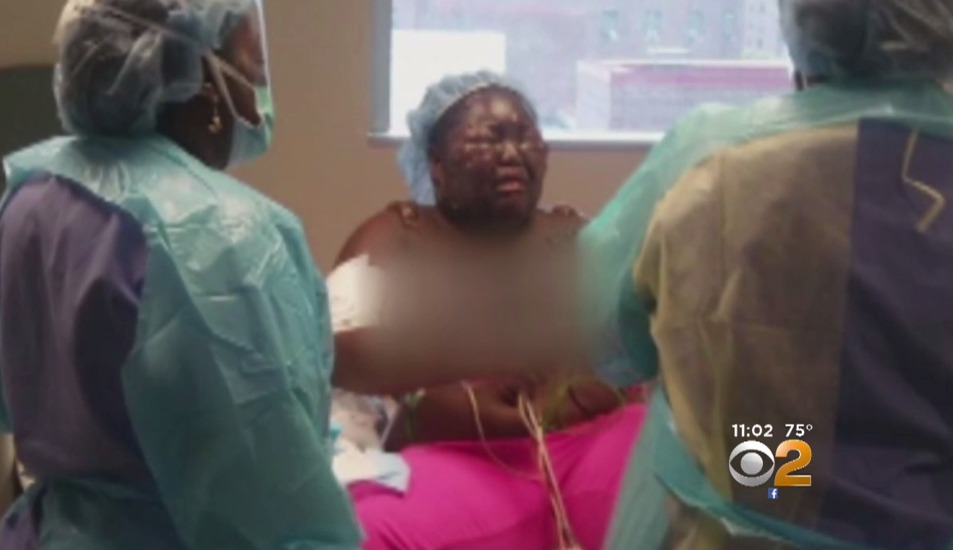 Girls Face Severely Burned When Another Girl Pours Boiling Water On