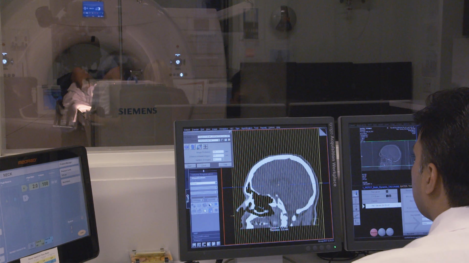 Brain Imaging Studies Seek Signs Of >> Scientists Seek Veterans To Help Treat Cte Brain Imaging Studies Seek Signs Of >> Scientists Seek Veterans To Help Treat Cte