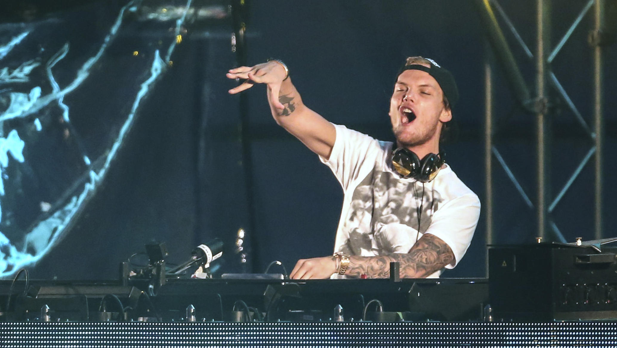 What Is Pancreatitis The Condition Avicii Suffered From Years Before Death Cbs News
