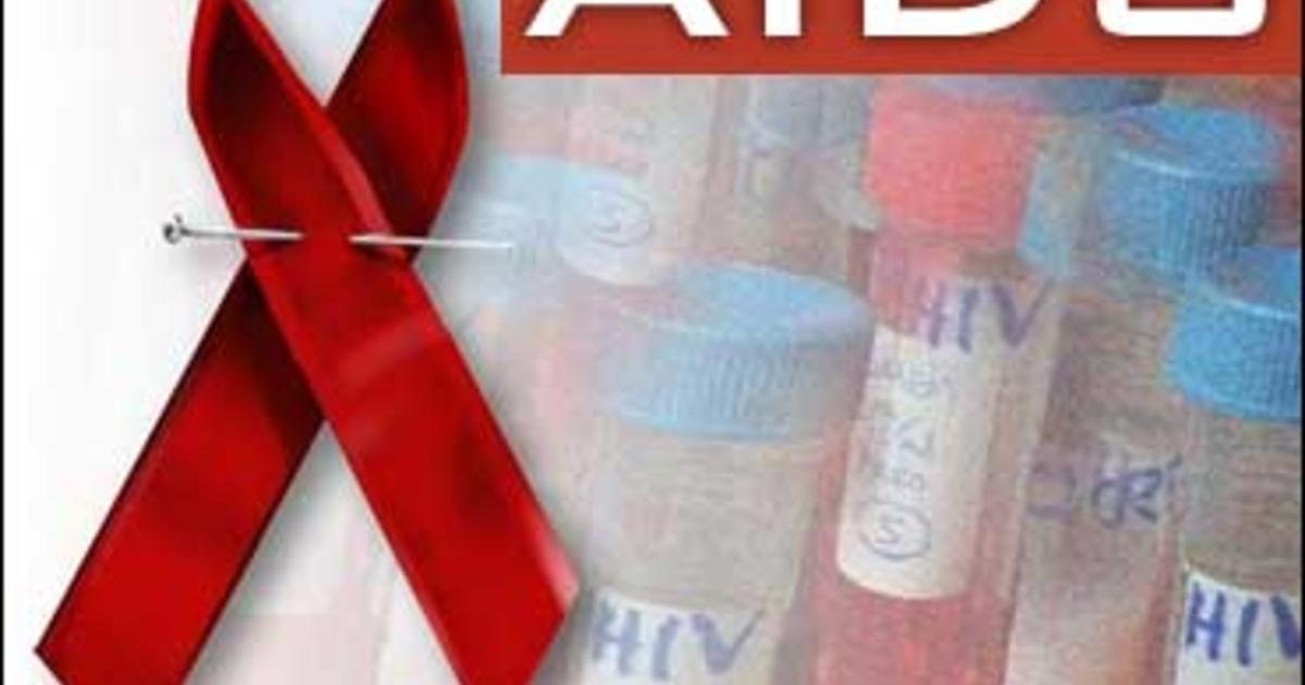 Hiv Infections Rising In U S Cbs News