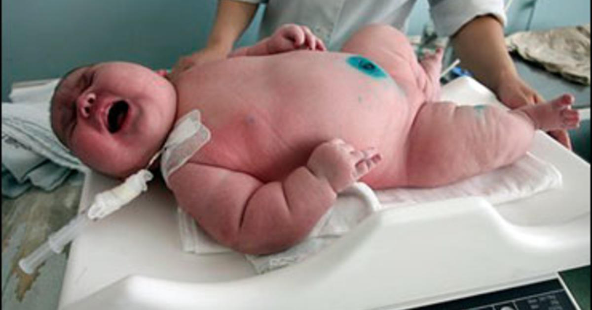 Image result for Ukraine's heaviest baby born