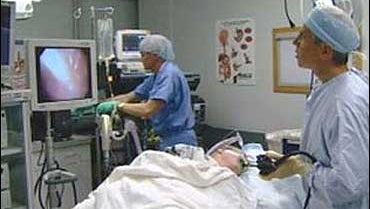 New Surgery For Acid Reflux Sufferers CBS News