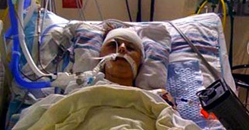 Student Victim of Savage SteelToed Stomping In Coma, But Her Doctors