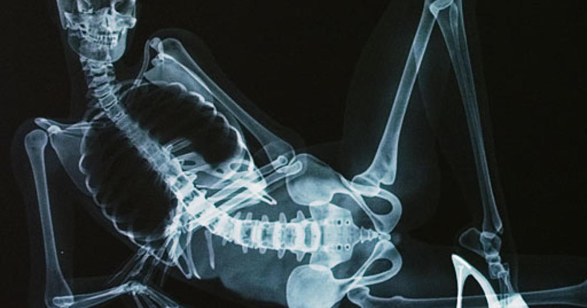 XXX X-Ray Pictures: Naked Anatomy Lesson Shocks Senses 