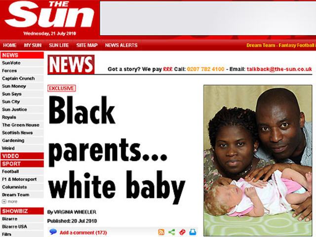 Baby white family black Sandra Laing: