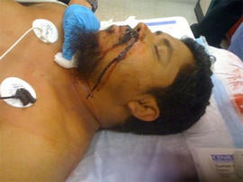 Cabbie Ahmed Sharif Stabbed: Michael Enright Asks "Are You Muslim?" and Slashes Driver, Say Cops