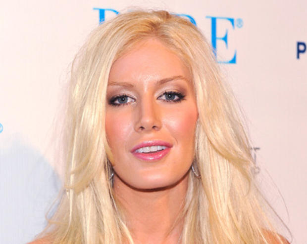 Heidi Montag Is Desperate For A Breast Reduction Cbs News